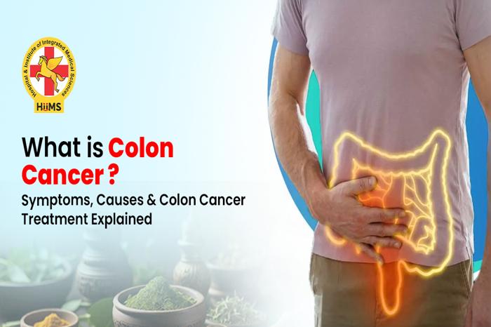 colon cancer treatment